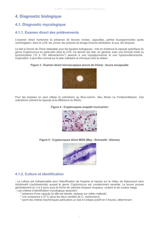 © UMVF - Université Médicale Virtuelle Francophone
4. Diagnostic biologique
4.1. Diagnostic mycologique
4.1.1. Examen direct des prélèvements
L'examen direct recherche la présence de levures rondes, capsulées, parfois bourgeonnantes après
centrifugation, dans le LCR, les urines, les produits du lavage broncho-alvéolaire, le pus, les biopsies.
Le test à l'encre de Chine réalisable pour les liquides biologiques : met en évidence la capsule spécifique du
genre Cryptococcus en particulier dans le LCR. Ce dernier est clair, en général, avec une formule mixte ou
lymphocytaire (10 à 100 éléments/mm3
) associé à une hypoglycorachie et une hyperprotéinorachie.
Cependant, il peut être normal sur le plan cellulaire et chimique chez le sidéen.
Figure 3 : Examen direct microscopique (encre de Chine) : levure encapsulée
Pour les biopsies on peut utiliser la colorations au Muci-carmin, bleu Alcian ou Fontana-Masson. Ces
colorations colorent la capsule (à la différence du MGG).
Figure 4 : Cryptocoques anapath mucicarmin
Figure 5 : Cryptocoques direct MGG (May - Grünwald - Giemsa)
4.1.2. Culture et identification
- La culture est indispensable pour l'identification de l'espèce et repose sur le milieu de Sabouraud sans
Actidione® (cycloheximide) auquel le genre Cryptococcus est constamment sensible. La levure pousse
généralement en 3 à 5 jours sous la forme de colonies d'aspect muqueux, coulant et de couleur beige.
- Les critères d’identification mycologique associent :
* présence d'une capsule (si elle est réduite, repiquer sur milieu maltosé)
* une croissance à 37°C (pour les deux variétés de C. neoformans)
* parmi les critères biochimiques particuliers un test à l’uréase positif en 3 heures, déterminant
6
 