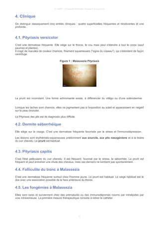 © UMVF - Université Médicale Virtuelle Francophone
4. Clinique
On distingue classiquement cinq entités cliniques : quatre superficielles fréquentes et récidivantes et une
profonde.
4.1. Pityriasis versicolor
C'est une dermatose fréquente. Elle siège sur le thorax, le cou mais peut s'étendre à tout le corps (sauf
paumes et plantes).
Il s'agit de macules de couleur chamois, finement squameuses ("signe du copeau"), qui s'étendent de façon
centrifuge.
Figure 1 : Malassezia Pityriasis
Le prurit est inconstant. Une forme achromiante existe, à différencier du vitiligo ou d'une sclérodermie.
Lorsque les taches sont chamois, elles ne pigmentent pas à l'exposition au soleil et apparaissent en négatif
sur la peau bronzée.
Le Pityriasis des plis est de diagnostic plus difficile.
4.2. Dermite séborrhéique
Elle siège sur le visage. C'est une dermatose fréquente favorisée par le stress et l'immunodépression.
Les lésions sont érythémato-squameuses prédominent aux sourcils, aux plis nasogéniens et à la lisière
du cuir chevelu. Le prurit est habituel.
4.3. Pityriasis capitis
C'est l'état pelliculaire du cuir chevelu. Il est fréquent, favorisé par le stress, la séborrhée. Le prurit est
fréquent et peut entraîner une chute des cheveux, mais ces derniers ne tombent pas spontanément.
4.4. Folliculite du tronc à Malassezia
C'est une dermatose fréquente surtout chez l'homme jeune. Le prurit est habituel. Le siège habituel est le
dos avec une association possible de la face antérieure du thorax.
4.5. Les fongémies à Malassezia
Elles sont rares et surviennent chez des prématurés ou des immunodéprimés nourris par intralipides par
voie intraveineuse. La première mesure thérapeutique consiste à retirer le cathéter.
4
 