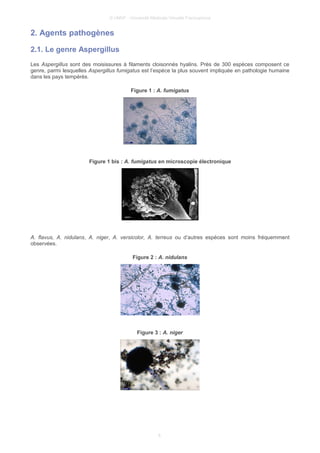 © UMVF - Université Médicale Virtuelle Francophone
2. Agents pathogènes
2.1. Le genre Aspergillus
Les Aspergillus sont des moisissures à filaments cloisonnés hyalins. Près de 300 espèces composent ce
genre, parmi lesquelles Aspergillus fumigatus est l’espèce la plus souvent impliquée en pathologie humaine
dans les pays tempérés.
Figure 1 : A. fumigatus
Figure 1 bis : A. fumigatus en microscopie électronique
A. flavus, A. nidulans, A. niger, A. versicolor, A. terreus ou d’autres espèces sont moins fréquemment
observées.
Figure 2 : A. nidulans
Figure 3 : A. niger
6
 