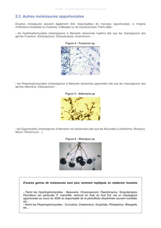 © UMVF - Université Médicale Virtuelle Francophone
2.2. Autres moisissures opportunistes
D’autres moisissures peuvent également être responsables de mycoses opportunistes, à l’origine
d’infections localisées ou invasives, d’allergies ou de mycotoxicoses. Parmi elles :
- les Hyalohyphomycètes (champignons à filaments cloisonnés hyalins) tels que les champignons des
genres Fusarium, Scedosporium, Scopulariopsis, Acremonium …
Figure 4 : Fusarium sp.
- les Phaeohyphomycètes (champignons à filaments cloisonnés pigmentés) tels que les champignons des
genres Alternaria, Cladosporium…
Figure 5 : Alternaria sp.
- les Zygomycètes (champignons à filaments non-cloisonnés) tels que les Mucorales (Lichtheimia, Rhizopus,
Mucor, Rhizomucor…).
Figure 6 : Rhizopus sp.
D’autres genres de moisissures sont plus rarement impliqués en médecine humaine.
- Parmi les Hyalohyphomycètes : Beauveria, Chrysosporium, Paecilomyces, Scopulariopsis,
Penicillium (en particulier P. marneffei, retrouvé en Asie du Sud Est, est un champignon
opportuniste au cours du SIDA et responsable de la pénicilliose disséminée souvent mortelle),
etc…
- Parmi les Phaeohyphomycètes : Curvularia, Chaetomium, Exophiala, Phialophora, Wangiella,
etc…
7
 