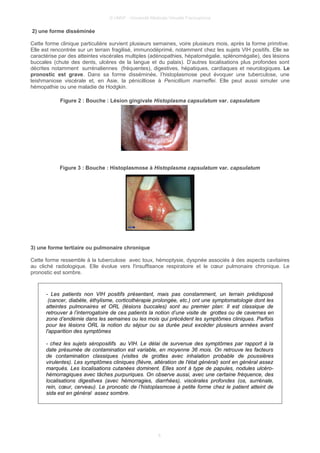 © UMVF - Université Médicale Virtuelle Francophone
2) une forme disséminée
Cette forme clinique particulière survient plusieurs semaines, voire plusieurs mois, après la forme primitive.
Elle est rencontrée sur un terrain fragilisé, immunodéprimé, notamment chez les sujets VIH positifs. Elle se
caractérise par des atteintes viscérales multiples (adénopathies, hépatomégalie, splénomégalie), des lésions
buccales (chute des dents, ulcères de la langue et du palais). D’autres localisations plus profondes sont
décrites notamment surrénaliennes (fréquentes), digestives, hépatiques, cardiaques et neurologiques. Le
pronostic est grave. Dans sa forme disséminée, l’histoplasmose peut évoquer une tuberculose, une
leishmaniose viscérale et, en Asie, la pénicilliose à Penicillium marneffei. Elle peut aussi simuler une
hémopathie ou une maladie de Hodgkin.
Figure 2 : Bouche : Lésion gingivale Histoplasma capsulatum var. capsulatum
Figure 3 : Bouche : Histoplasmose à Histoplasma capsulatum var. capsulatum
3) une forme tertiaire ou pulmonaire chronique
Cette forme ressemble à la tuberculose avec toux, hémoptysie, dyspnée associés à des aspects cavitaires
au cliché radiologique. Elle évolue vers l'insuffisance respiratoire et le cœur pulmonaire chronique. Le
pronostic est sombre.
- Les patients non VIH positifs présentant, mais pas constamment, un terrain prédisposé
(cancer, diabète, éthylisme, corticothérapie prolongée, etc.) ont une symptomatologie dont les
atteintes pulmonaires et ORL (lésions buccales) sont au premier plan: Il est classique de
retrouver à l’interrogatoire de ces patients la notion d’une visite de grottes ou de cavernes en
zone d’endémie dans les semaines ou les mois qui précédent les symptômes cliniques. Parfois
pour les lésions ORL la notion du séjour ou sa durée peut excéder plusieurs années avant
l'apparition des symptômes
- chez les sujets séropositifs au VIH. Le délai de survenue des symptômes par rapport à la
date présumée de contamination est variable, en moyenne 36 mois. On retrouve les facteurs
de contamination classiques (visites de grottes avec inhalation probable de poussières
virulentes). Les symptômes cliniques (fièvre, altération de l'état général) sont en général assez
marqués. Les localisations cutanées dominent. Elles sont à type de papules, nodules ulcéro-
hémorragiques avec tâches purpuriques. On observe aussi, avec une certaine fréquence, des
localisations digestives (avec hémorragies, diarrhées), viscérales profondes (os, surrénale,
rein, cœur, cerveau). Le pronostic de l’histoplasmose à petite forme chez le patient atteint de
sida est en général assez sombre.
6
 