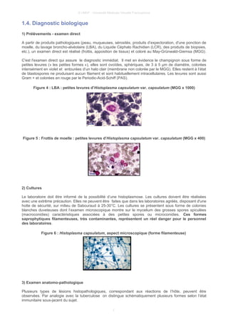 © UMVF - Université Médicale Virtuelle Francophone
1.4. Diagnostic biologique
1) Prélèvements - examen direct
A partir de produits pathologiques (peau, muqueuses, sérosités, produits d’expectoration, d'une ponction de
moelle, du lavage broncho-alvéolaire (LBA), du Liquide Céphalo Rachidien (LCR), des produits de biopsies,
etc.), un examen direct est réalisé (frottis, apposition de tissus) et coloré au May-Grünwald-Giemsa (MGG).
C'est l'examen direct qui assure le diagnostic immédiat. Il met en évidence le champignon sous forme de
petites levures (« les petites formes »), elles sont ovoïdes, sphériques, de 3 à 5 µm de diamètre, colorées
intensément en violet et entourées d’un halo clair (membrane non colorée par le MGG). Elles restent à l’état
de blastospores ne produisant aucun filament et sont habituellement intracellulaires. Les levures sont aussi
Gram + et colorées en rouge par le Periodic-Acid-Schiff (PAS).
Figure 4 : LBA : petites levures d'Histoplasma capsulatum var. capsulatum (MGG x 1000)
Figure 5 : Frottis de moelle : petites levures d'Histoplasma capsulatum var. capsulatum (MGG x 400)
2) Cultures
Le laboratoire doit être informé de la possibilité d’une histoplasmose. Les cultures doivent être réalisées
avec une extrême précaution. Elles ne peuvent être faites que dans les laboratoires agréés, disposant d'une
hotte de sécurité, sur milieu de Sabouraud à 25-30°C. Les cultures se présentent sous forme de colonies
blanches duveteuses dont l’examen microscopique montre sur le mycelium des grosses spores spiculées
(macroconidies) caractéristiques associées à des petites spores ou microconidies. Ces formes
saprophytiques filamenteuses, très contaminantes, représentent un réel danger pour le personnel
des laboratoires.
Figure 6 : Histoplasma capsulatum, aspect microscopique (forme filamenteuse)
3) Examen anatomo-pathologique
Plusieurs types de lésions histopathologiques, correspondant aux réactions de l’hôte, peuvent être
observées. Par analogie avec la tuberculose on distingue schématiquement plusieurs formes selon l’état
immunitaire sous-jacent du sujet.
7
 