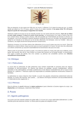 © UMVF - Université Médicale Virtuelle Francophone
Figure 5 : Larve de Pediculus humanus
(Photo A. Izri)
Dès sa naissance, le pou pique son hôte pour se nourrir, il effectue 3 à 4 repas de sang par jour. Le stade
adulte est atteint en 12 à 15 jours, après 3 mues et un stade nymphal. Il se passe ainsi 18 à 20 jours
depuis la ponte de l’œuf jusqu’à l’apparition de l’adulte.
Pediculus capitis ne vit que sur le cuir chevelu humain où il se cache entre les cheveux. Hors de ce milieu
et sans repas sanguin, il meurt en moins d’une journée. La transmission d’un sujet à l’autre a lieu lors
d’un contact direct, cheveux contre cheveux. Elle est possible par l’intermédiaire de brosses à cheveux ou
de peignes. Lors d’une infestation massive (plusieurs centaines de poux sur une tête), les parasites peuvent
quitter le cuir chevelu et se retrouver sur le col des vêtements, les écharpes, voire sur l’oreiller : dans ces
conditions, ces objets deviennent temporairement contaminants.
Pediculus humanus vit à la face interne des vêtements et ne va sur la peau que pour se nourrir. Dans les
vêtements ou dans la literie, il peut survivre sans se nourrir pendant 2 à 3 jours. Ce sont donc les vêtements
ou la literie contaminés qui assurent essentiellement la transmission des poux de corps.
Pthirus pubis vit accroché aux poils du pubis, il se retrouve parfois au niveau des poils sous axillaires, de la
barbe, des sourcils, des cils et, chez l’enfant, au niveau des cheveux sur la frange frontale. La transmission
d’un sujet à l’autre est directe, lors d’un contact. La pthirose est considérée comme une infection
sexuellement transmissible.
1.2. Clinique
1.2.1. Pédiculoses
Le prurit dans la pédiculose de tête prédomine chez l’enfant (maternelle et primaire) dans les régions
occipitales et rétro-auriculaires. On observe des lésions de grattage, souvent impétiginisées, (parfois
associées à des adénopathies cervicales postérieures) et des lésions eczématiformes de la nuque et des
épaules en « pélerine ». Pediculus capitis est responsable de véritables épidémies récidivantes scolaires et
familiales.
La pédiculose du corps s’observe chez l’adulte. Le prurit, les papules urticariennes prédominent entre les
épaules, au niveau des hanches, des cuisses…. Les lésions chroniques entraînent une leucomélanodermie
(« mélanodermie des vagabonds »).
1.2.2. Pthirose
Dans la pthirose, le prurit intéresse la région pubienne et peut s’étendre à d’autres régions du corps. Les
blépharites sont classiques, notamment chez l’enfant.
2. Puces
2.1. Agents pathogènes
Les puces sont des insectes aptères de petite taille (1 à 8 mm) et à corps aplati latéro-latéralement. La tête
carénée porte des antennes courtes. La 3ième paire de pattes est adaptée au saut.
5
 