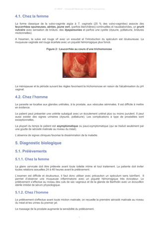 © UMVF - Université Médicale Virtuelle Francophone
4.1. Chez la femme
La forme classique de la vulvo-vaginite aigüe à T. vaginalis (25 % des vulvo-vaginites) associe des
leucorrhées spumeuses, aérées, jaune vert, (parfois blanchâtres) continuelles et nauséabondes, un prurit
vulvaire avec sensation de brûlure, des dyspareunies et parfois une cystite (dysurie, pollakiurie, brûlures
mictionnelles).
A l'examen, la vulve est rouge vif avec un exsudat et l'introduction du spéculum est douloureuse. La
muqueuse vaginale est rouge écarlate avec un piqueté hémorragique plus foncé.
Figure 2 : Leucorrhée au cours d’une trichomonose
La ménopause et la période suivant les règles favorisent la trichomonose en raison de l'alcalinisation du pH
vaginal.
4.2. Chez l’homme
Le parasite se localise aux glandes urétrales, à la prostate, aux vésicules séminales. Il est difficile à mettre
en évidence.
Le patient peut présenter une urétrite subaiguë avec un écoulement urétral plus ou moins purulent. Il peut
aussi exister des signes urinaires (dysurie, pollakiurie). Les complications à type de prostatites sont
exceptionnelles.
La plupart du temps le patient est asymptomatique ou pauci-symptomatique (qui se traduit seulement par
une goutte de sérosité matinale au niveau du méat).
L’absence de signes cliniques favorise la dissémination de la maladie.
5. Diagnostic biologique
5.1. Prélèvements
5.1.1. Chez la femme
La glaire cervicale doit être prélevée avant toute toilette intime et tout traitement. La patiente doit éviter
toutes relations sexuelles 24 à 48 heures avant le prélèvement.
L’examen est difficile et douloureux, il faut donc utiliser avec précaution un spéculum sans lubrifiant. Il
permet d’observer une muqueuse inflammatoire avec un piqueté hémorragique très évocateur. Le
prélèvement s’effectue au niveau des culs de sac vaginaux et de la glande de Bartholin avec un écouvillon
stérile imbibé de sérum physiologique.
5.1.2. Chez l’homme
Le prélèvement s'effectue avant toute miction matinale; on recueille la première sérosité matinale au niveau
du méat et les urines du premier jet.
Le massage de la prostate augmente la sensibilité du prélèvement.
5
 