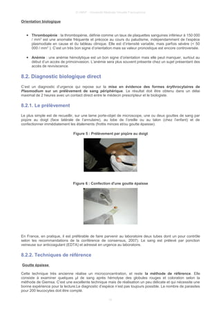 © UMVF - Université Médicale Virtuelle Francophone
Orientation biologique
● Thrombopénie : la thrombopénie, définie comme un taux de plaquettes sanguines inférieur à 150 000
/ mm3
est une anomalie fréquente et précoce au cours du paludisme, indépendamment de l’espèce
plasmodiale en cause et du tableau clinique. Elle est d’intensité variable, mais parfois sévère (< 50
000 / mm3
). C’est un très bon signe d’orientation mais sa valeur pronostique est encore controversée.
● Anémie : une anémie hémolytique est un bon signe d’orientation mais elle peut manquer, surtout au
début d’un accès de primoinvasion. L’anémie sera plus souvent présente chez un sujet présentant des
accès de reviviscence.
8.2. Diagnostic biologique direct
C’est un diagnostic d’urgence qui repose sur la mise en évidence des formes érythrocytaires de
Plasmodium sur un prélèvement de sang périphérique. Le résultat doit être obtenu dans un délai
maximal de 2 heures avec un contact direct entre le médecin prescripteur et le biologiste.
8.2.1. Le prélèvement
Le plus simple est de recueillir, sur une lame porte-objet de microscope, une ou deux gouttes de sang par
piqûre au doigt (face latérale de l’annulaire), au lobe de l’oreille ou au talon (chez l’enfant) et de
confectionner immédiatement les étalements (frottis minces et/ou goutte épaisse).
Figure 5 : Prélèvement par piqûre au doigt
Figure 6 : Confection d'une goutte épaisse
En France, en pratique, il est préférable de faire parvenir au laboratoire deux tubes dont un pour contrôle
selon les recommandations de la conférence de consensus, 2007). Le sang est prélevé par ponction
veineuse sur anticoagulant (EDTA) et adressé en urgence au laboratoire.
8.2.2. Techniques de référence
Goutte épaisse
Cette technique très ancienne réalise un microconcentration, et reste la méthode de référence. Elle
consiste à examiner quelques µl de sang après hémolyse des globules rouges et coloration selon la
méthode de Giemsa. C’est une excellente technique mais de réalisation un peu délicate et qui nécessite une
bonne expérience pour la lecture.Le diagnostic d’espèce n’est pas toujours possible. Le nombre de parasites
pour 200 leucocytes doit être compté.
19
 
