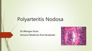 Polyarteritis Nodosa
Dr.Bhargav kiran
General Medicine Post Graduate
 