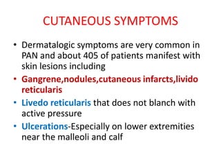 Pan Rash POLY ARTERITIS NODOSA POLY ARTERITIS NODOSA | PPTX
