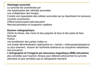 Histologie synoviale
La synovite est caractérisée par
une hypertrophie des villosités synoviales
une multiplication des franges.
Il existe une hyperplasie des cellules synoviales qui se répartissent en plusieurs
couches successives.
Infiltrat lymphocytaire périvasculaire
Néovascularisation et congestion capillaire
Examen radiographique
Cliché du thorax, des mains et des poignets de face et des pieds de face
Normale
Parfois :
une tuméfaction des parties molles ou
une simple déminéralisation épiphysaire en « bande » métacarpophalangienne
ou plus rarement : érosion de l’extrémité antérieure du cinquième métatarsien,
très évocatrice
L’échographie et l’imagerie par résonance magnétique (IRM) articulaires
plus sensibles que l’examen clinique pour détecter précocement la synovite
articulaire et plus sensibles que la radiographie standard
 