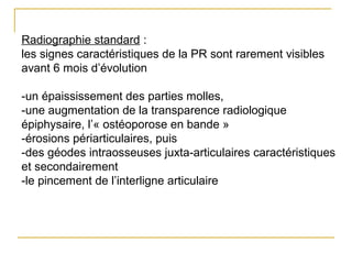 Radiographie standard :
les signes caractéristiques de la PR sont rarement visibles
avant 6 mois d’évolution
-un épaississement des parties molles,
-une augmentation de la transparence radiologique
épiphysaire, l’« ostéoporose en bande »
-érosions périarticulaires, puis
-des géodes intraosseuses juxta-articulaires caractéristiques
et secondairement
-le pincement de l’interligne articulaire
 