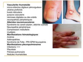 Vascularite rhumatoïde
micro-infarctus digitaux périunguéaux
ulcères profonds
livedo réticulaire
purpura vasculaire
nécroses digitales ou des orteils
neuropathies périphériques
Atteintes neuromusculaires
Syndrome du canal carpien, atteinte cubitale
Neuropathie périphérique
Compression médullaire
myalgies
Manifestations hématologiques
Anémie
Adénopathies
Syndrome de Felty : PR+SPM+leucopénie
Manifestations pleuropulmonaires
Infections +++
Pleurésie
Fibrose pulmonaire
Nodules rhumatoïdes
 
