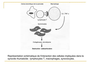 Représentation schématique de l'interaction des cellules impliquées dans la
synovite rhumatoïde : lymphocytes T, macrophages, synoviocytes.
 