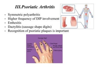 • Symmetric polyarthritis
• Higher frequency of DIP involvement
• Enthesitis
• Dactylitis (sausage shape digits)
• Recognition of psoriatic plaques is important
III.Psoriatic Arthritis
 