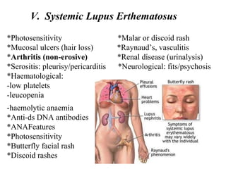 *Photosensitivity *Malar or discoid rash
*Mucosal ulcers (hair loss) *Raynaud’s, vasculitis
*Arthritis (non-erosive) *Renal disease (urinalysis)
*Serositis: pleurisy/pericarditis *Neurological: fits/psychosis
*Haematological:
-low platelets
-leucopenia
-haemolytic anaemia
*Anti-ds DNA antibodies
*ANAFeatures
*Photosensitivity
*Butterfly facial rash
*Discoid rashes
V. Systemic Lupus Erthematosus
 