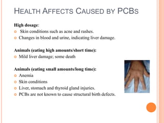 HEALTH AFFECTS CAUSED BY PCBS
High dosage:
 Skin conditions such as acne and rashes.
 Changes in blood and urine, indicating liver damage.
Animals (eating high amounts/short time):
 Mild liver damage; some death
Animals (eating small amounts/long time):
 Anemia
 Skin conditions
 Liver, stomach and thyroid gland injuries.
 PCBs are not known to cause structural birth defects.
 