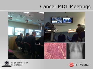 Cancer MDT Meetings 