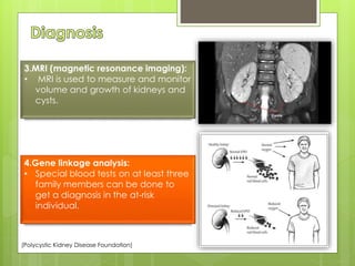3.MRI (magnetic resonance imaging): 
• MRI is used to measure and monitor 
volume and growth of kidneys and 
cysts. 
4.Gene linkage analysis: 
• Special blood tests on at least three 
family members can be done to 
get a diagnosis in the at-risk 
individual. 
(Polycystic Kidney Disease Foundation) 
 