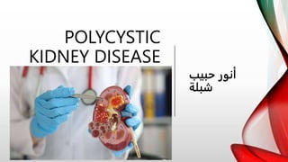 POLYCYSTIC
KIDNEY DISEASE
‫حبيب‬ ‫أنور‬
‫شبلة‬
 