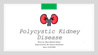 Polycystic Kidney
Disease
Done by: Mays Khaled Najjar
Supervised by: Dr. Sameer Zawahreh
Date: 3/22/2023
3/22/2023
1
 