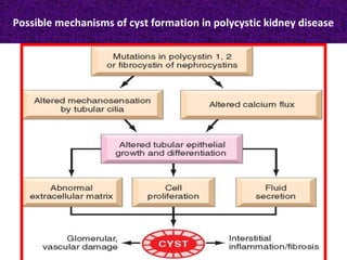 Possible mechanisms of cyst formation in polycystic kidney disease
 