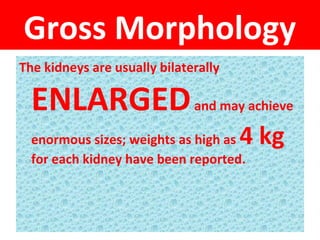 Gross Morphology
The kidneys are usually bilaterally
ENLARGEDand may achieve
enormous sizes; weights as high as 4 kg
for each kidney have been reported.
 