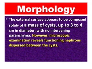 Morphology
• The external surface appears to be composed
solely of a mass of cysts, up to 3 to 4
cm in diameter, with no intervening
parenchyma. However, microscopic
examination reveals functioning nephrons
dispersed between the cysts.
 