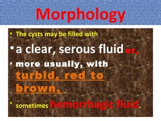 Morphology
• The cysts may be filled with
•a clear, serous fluidor,
• more usually, with
turbid, red to
brown,
• sometimes hemorrhagic fluid.
 