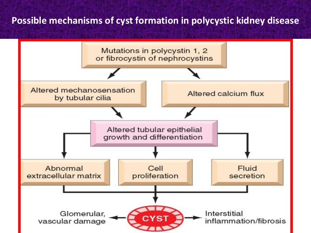 Polycystic kidney disease for students