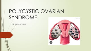 POLYCYSTIC OVARIAN SYNDROME PRESENTATION.pptx