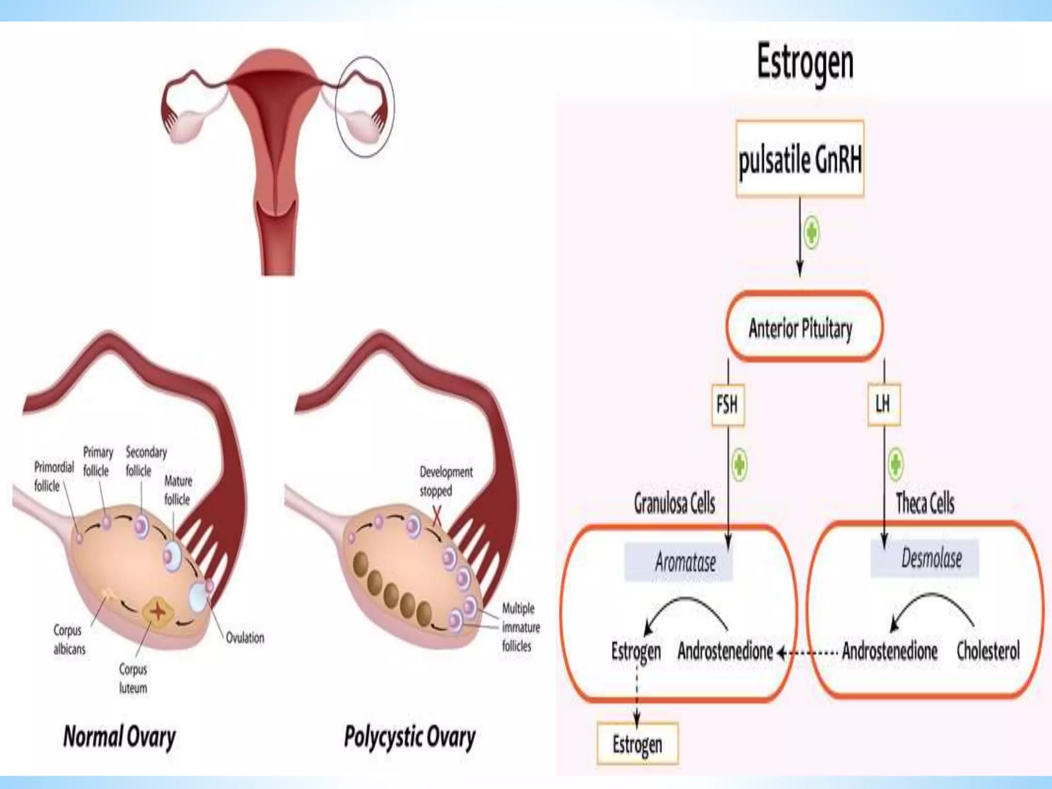Polycystic ovarian syndrome and role of physical therapy (1) | PDF