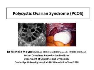Polycystic Ovarian Syndrome (PCOS)
Dr Michelle M Fynes MB BAO BCH (Hons) MD (Research) MRCOG DU DipUS
Locum Consultant Reproductive Medicine
Department of Obstetrics and Gynecology
Cambridge University Hospitals NHS Foundation Trust 2018
 