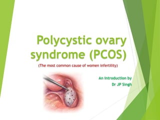 Polycystic ovary
syndrome (PCOS)
(The most common cause of women infertility)
An Introduction by
Dr JP Singh
 