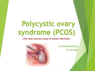 Polycystic ovary
syndrome (PCOS)
(The most common cause of women infertility)
An Introduction by
Dr JP Singh
 