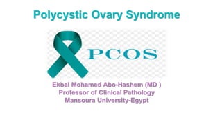 Polycystic Ovary Syndrome
Ekbal Mohamed Abo-Hashem (MD )
Professor of Clinical Pathology
Mansoura University-Egypt
 