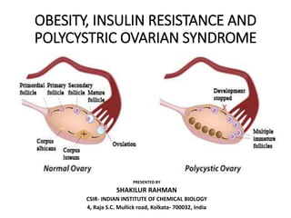OBESITY, INSULIN RESISTANCE AND
POLYCYSTRIC OVARIAN SYNDROME
PRESENTED BY
SHAKILUR RAHMAN
CSIR- INDIAN INSTITUTE OF CHEMICAL BIOLOGY
4, Raja S.C. Mullick road, Kolkata- 700032, India
 