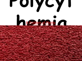 Polycyt
hemiaA Problem of Plenty
 