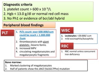Diagnostic criteria
1. platelet count > 600 x 10 9/L
2. Hgb < 13.0 g/dl or normal red cell mass
3. No Ph1 or evidence of bcr/abl hybrid
1. Leukocytes: <20.000/ cum
2. mild eosinophilia/basophilia
1. RBC normal unless concurrent
iron deficiency
1. PLTs count: over 600.000/cum
could be reach > 1.000.000
/cum
2. thrombocytosis with giant
platelets ; bizarre forms
3. increased MPV
4. circulating megakaryocytes and
megakaryocytic fragments
Peripheral blood findings
PLT
WBC
RBC
Bone marrow:
1. Marked clustering of megakaryocytes
2. Half of patients show the JAK2 (Va1617Phe) mutation
 