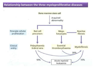 Relationship between the three myeloproliferative diseases
 