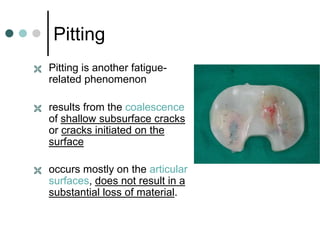 Differinal Pitting Polyethylene Damage Mechanisms in Total Hip & Total knee Surgeries ,DR ...