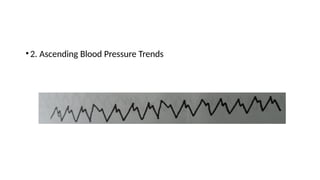 •2. Ascending Blood Pressure Trends
 