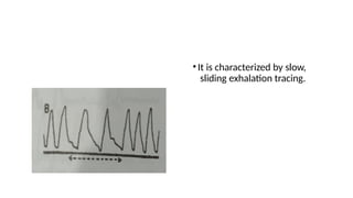 •It is characterized by slow,
sliding exhalation tracing.
 