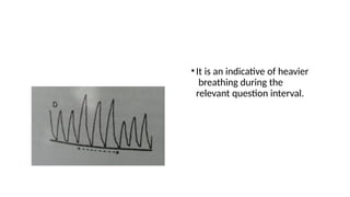 •It is an indicative of heavier
breathing during the
relevant question interval.
 