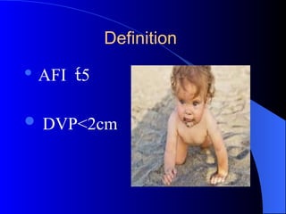 Definition
 AFI 5
 DVP<2cm
 