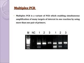 Polymerase Chain Reaction | PPT