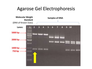 Agarose Gel Electrophoresis
Molecular Weight
Standard
(DNA of Known Sizes)
1 2 3 4 5 6 7 8 9 10
Samples of DNA
2000 bp
1000 bp
750 bp
Lanes:
5000 bp
 