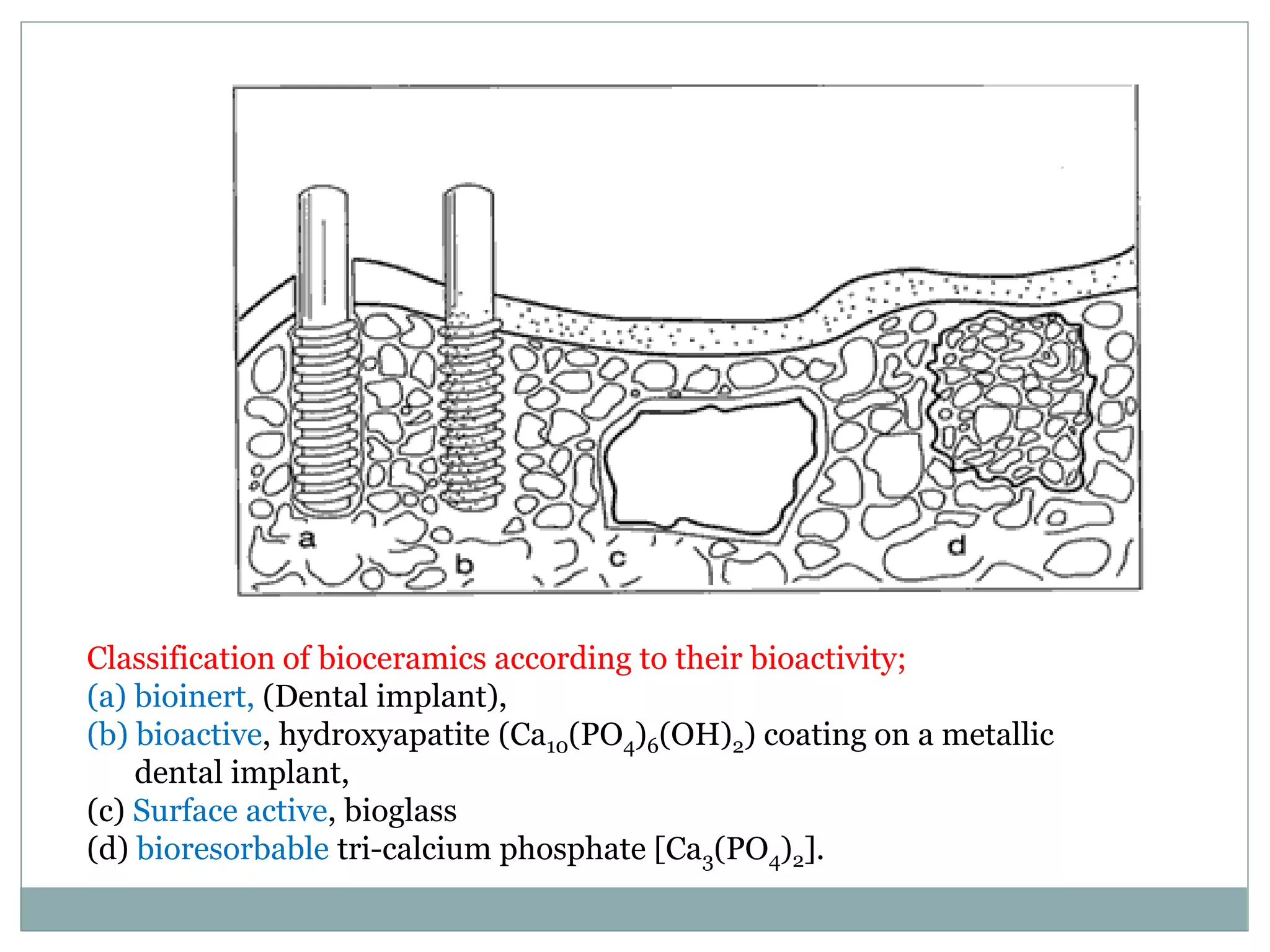 Classification of bioceramics according to their bioactivity;
(a) bioinert, (Dental implant),
(b) bioactive, hydroxyapatite (Ca10(PO4)6(OH)2) coating on a metallic
dental implant,
(c) Surface active, bioglass
(d) bioresorbable tri-calcium phosphate [Ca3(PO4)2].
 