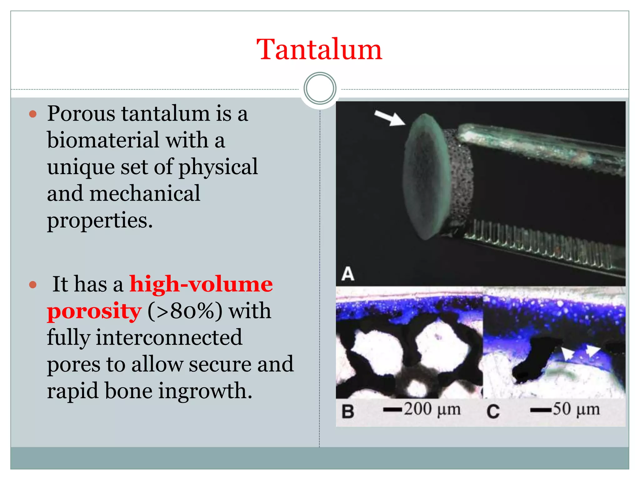 Tantalum
 Porous tantalum is a
biomaterial with a
unique set of physical
and mechanical
properties.
 It has a high-volume
porosity (>80%) with
fully interconnected
pores to allow secure and
rapid bone ingrowth.
 