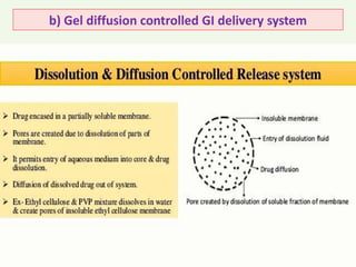 b) Gel diffusion controlled GI delivery system
 