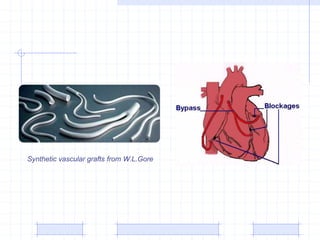 Synthetic vascular grafts from W.L.Gore
 