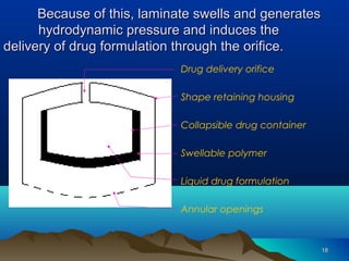 1188 
BBeeccaauussee ooff tthhiiss,, llaammiinnaattee sswweellllss aanndd ggeenneerraatteess 
hhyyddrrooddyynnaammiicc pprreessssuurree aanndd iinndduucceess tthhee 
ddeelliivveerryy ooff ddrruugg ffoorrmmuullaattiioonn tthhrroouugghh tthhee oorriiffiiccee.. 
Drug delivery orifice 
Shape retaining housing 
Collapsible drug container 
Swellable polymer 
Liquid drug formulation 
Annular openings 
