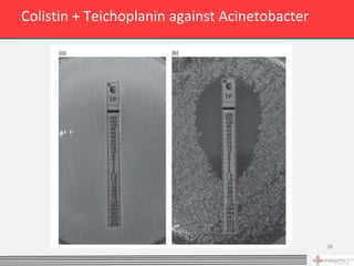 Colistin + Teichoplanin against Acinetobacter




                                                38
 